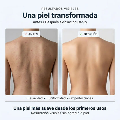 Toalla de ducha exfoliante Canily